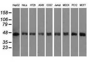m02241 anti dap kinase 2 dapk2 mouse monoclonal antibody clone id oti1c5 wb testing 2