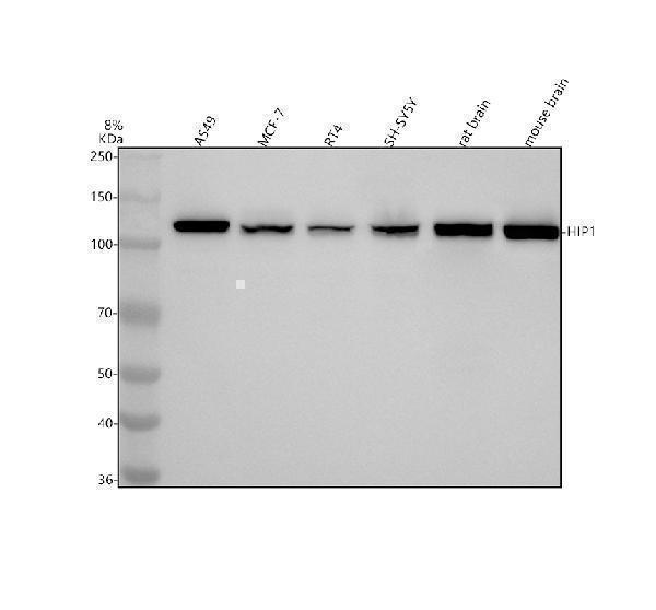 m02242 hip1 primary antibodies wb testing 1_1