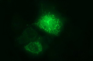 m02244 anti arg2 mouse monoclonal antibody clone id oti3g5 if testing 8