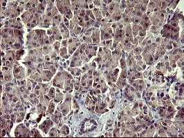 m02244 anti arg2 mouse monoclonal antibody clone id oti3g5 ihc testing 4