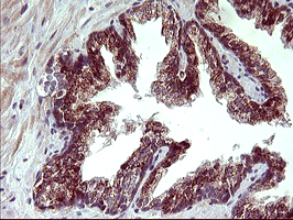 m02244 anti arg2 mouse monoclonal antibody clone id oti3g5 ihc testing 5