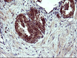 m02244 anti arg2 mouse monoclonal antibody clone id oti3g5 ihc testing 6