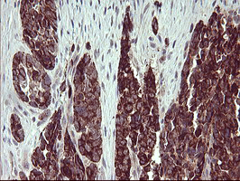 m02244 anti arg2 mouse monoclonal antibody clone id oti3g5 ihc testing 7