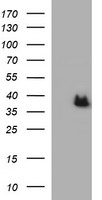HEK293T cells were transfected with the pCMV6-ENTRY control (Left lane) or pCMV6-ENTRY ARG2 (Right lane) cDNA for 48 hrs and lysed