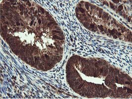 m02246 anti ruvbl2 mouse monoclonal antibody clone id oti1a6 ihc testing 6