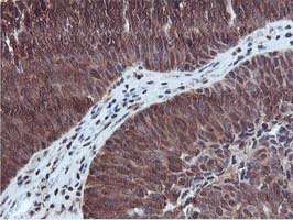 m02246 anti ruvbl2 mouse monoclonal antibody clone id oti1a6 ihc testing 7