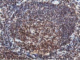 m02246 anti ruvbl2 mouse monoclonal antibody clone id oti1a6 ihc testing 8
