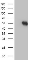HEK293T cells were transfected with the pCMV6-ENTRY control (Left lane) or pCMV6-ENTRY RUVBL2 (Right lane) cDNA for 48 hrs and lysed