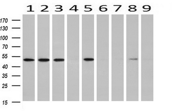 Western blot analysis of extracts (10ug) from 9 Human tissue by using anti-RUVBL2 monoclonal antibody at 1:200 (1: Testis; 2: Omentum; 3: Uterus; 4: Breast; 5: Brain; 6: Liver; 7: Ovary; 8: Thyroid gland; 9: colon)