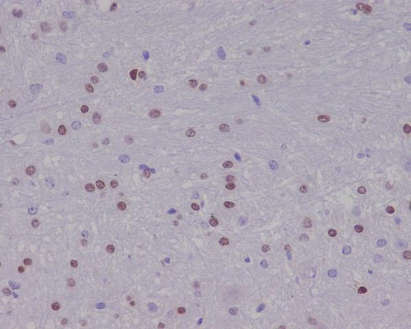Immunohistochemical analysis of paraffin-embedded human mouse brain, using Olig2 Antibody