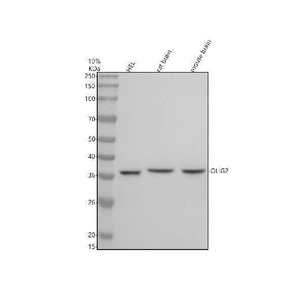 Western blot analysis of OLIG2 using anti-OLIG2 antibody (M02247)