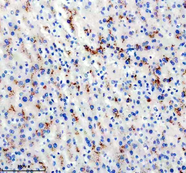 IHC analysis of DKK3 using anti-DKK3 antibody (M02248-1)
