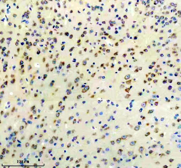 m02248 1 dkk3 primary antibodies ihc testing 3