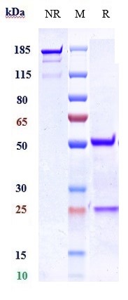 Anti-Nogo Receptor/NgR Reference Antibody (Abbott patent anti-NGR) on SDS-PAGE under reducing (R) condition