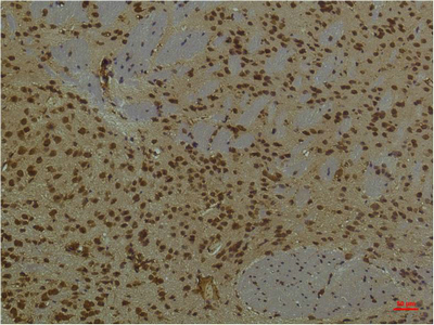 m02263 1 arnt primary antibodies ihc testing 1
