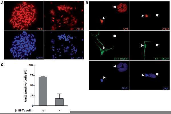 m02263 2 anti hif1 beta arnt mouse monoclonal antibody clone id oti1a1 if testing 15