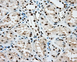 m02263 2 anti hif1 beta arnt mouse monoclonal antibody clone id oti1a1 ihc testing 10