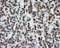 m02263 2 anti hif1 beta arnt mouse monoclonal antibody clone id oti1a1 ihc testing 3