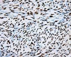 m02263 2 anti hif1 beta arnt mouse monoclonal antibody clone id oti1a1 ihc testing 6