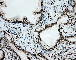 m02263 2 anti hif1 beta arnt mouse monoclonal antibody clone id oti1a1 ihc testing 7