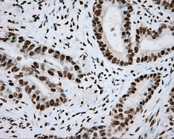 m02263 2 anti hif1 beta arnt mouse monoclonal antibody clone id oti1a1 ihc testing 9