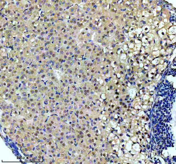 m02263 arnt primary antibodies ihc testing 3