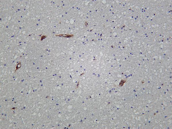 Human brain was stained with Anti-IFITM3 rabbit antibody