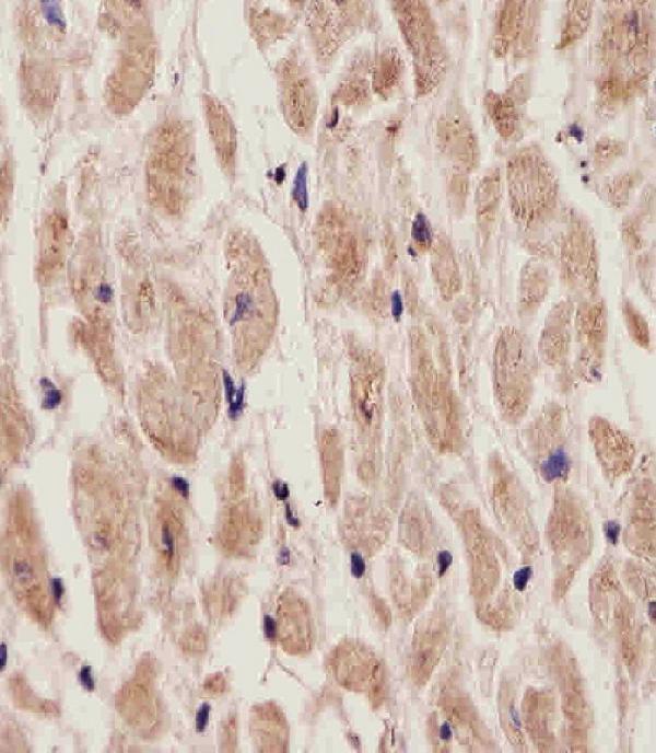 m02268 anti adora2a antibody c term ihc p testing 2