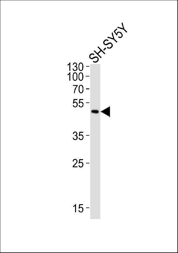 m02268 anti adora2a antibody c term wb testing 1
