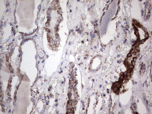 m02269 1 anti pik3cd mouse monoclonal antibody clone id oti1d11 ihc testing 12
