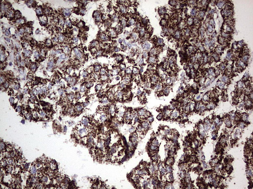 m02269 1 anti pik3cd mouse monoclonal antibody clone id oti1d11 ihc testing 13