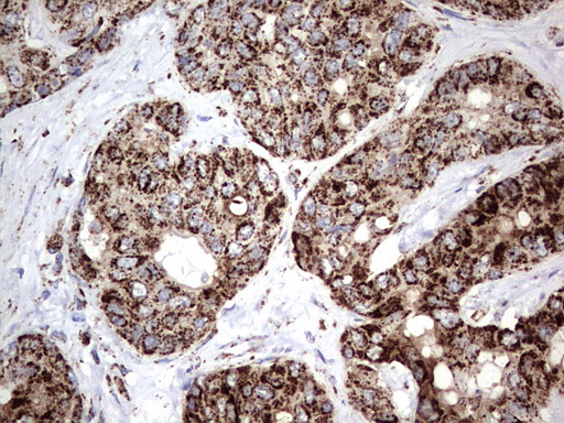 m02269 1 anti pik3cd mouse monoclonal antibody clone id oti1d11 ihc testing 15