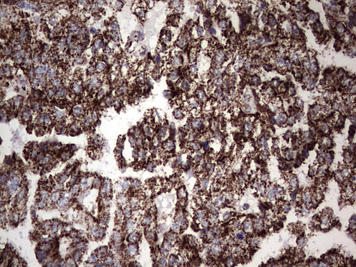 m02269 1 anti pik3cd mouse monoclonal antibody clone id oti1d11 ihc testing 2