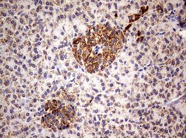 m02269 1 anti pik3cd mouse monoclonal antibody clone id oti1d11 ihc testing 3