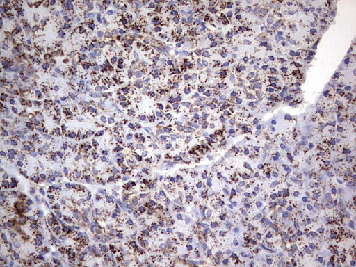m02269 1 anti pik3cd mouse monoclonal antibody clone id oti1d11 ihc testing 4