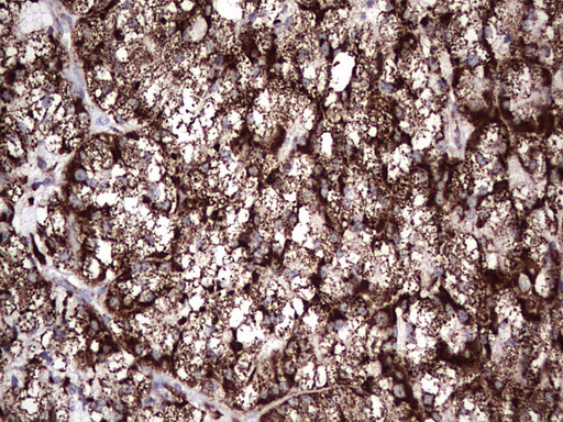m02269 1 anti pik3cd mouse monoclonal antibody clone id oti1d11 ihc testing 5