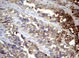 m02269 1 anti pik3cd mouse monoclonal antibody clone id oti1d11 ihc testing 6