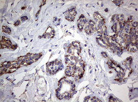 m02269 1 anti pik3cd mouse monoclonal antibody clone id oti1d11 ihc testing 7
