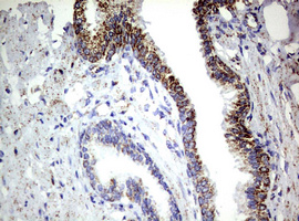m02269 1 anti pik3cd mouse monoclonal antibody clone id oti1d11 ihc testing 8