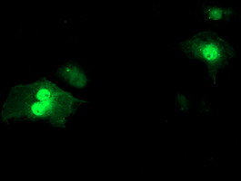 m02273 1 anti sds mouse monoclonal antibody clone id oti2c11 if testing 6