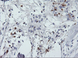 m02273 1 anti sds mouse monoclonal antibody clone id oti2c11 ihc testing 4