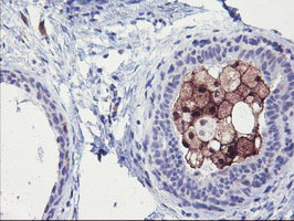 m02273 anti sds mouse monoclonal antibody clone id oti3d3 ihc testing 2