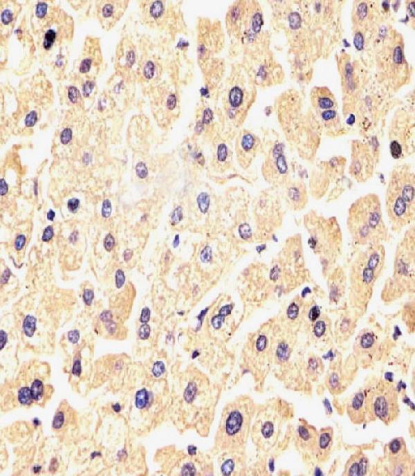 m02274 anti fgf9 antibody ihc testing 3