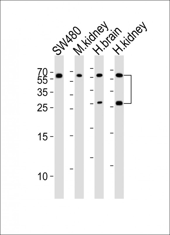 m02274 anti fgf9 antibody wb testing 1