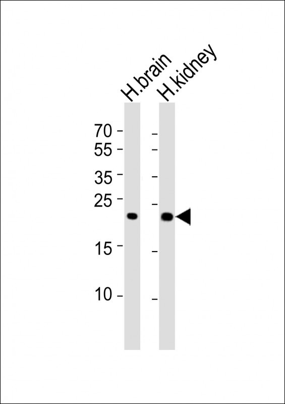 m02274 anti fgf9 antibody wb testing 2