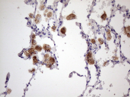 Immunohistochemical staining of paraffin-embedded Human lung tissue within the normal limits using anti-ALOX12 mouse monoclonal antibody