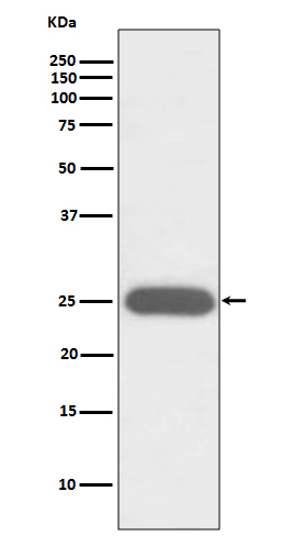 Western blot analysis of G-CSF expression in K562 cell lysate