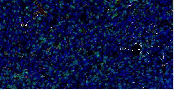 Fluorescence multiplex immunohistochemical analysis of  ​human tonsil tissue (formalin-fixed paraffin-embedded section)