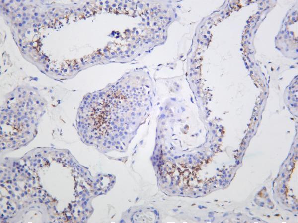 Human testis was stained with anti-CD206/MRC1 rabbit antibody