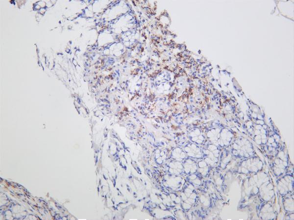 m02285 2 mrc1 primary antibodies ihc testing 3